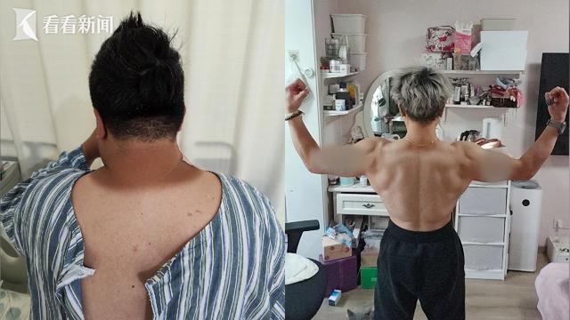 醫(yī)療機(jī)構(gòu)“喊你”科學(xué)減肥(圖6)